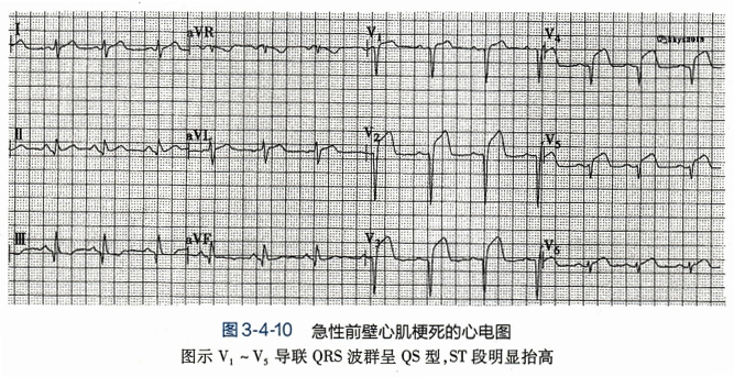 8741111-2.jpg